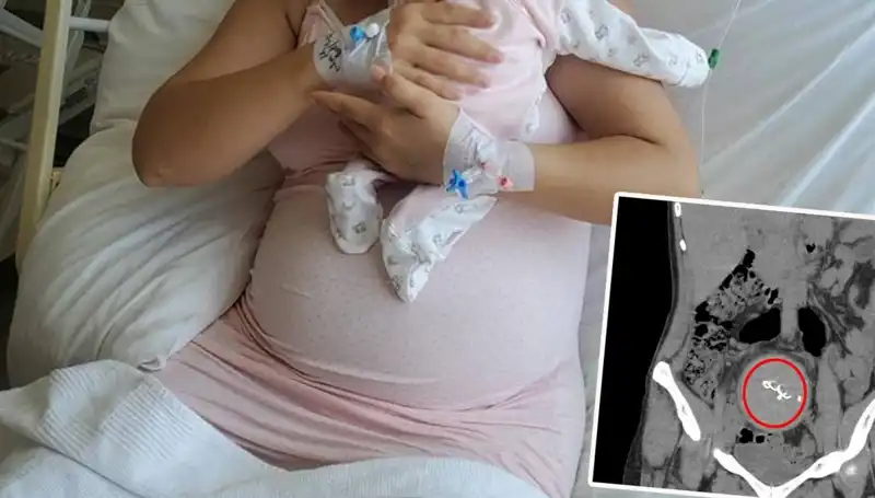 Doğumda Unutulan Bebeğin İhmalinin Ardındaki Skandal: Gazlı Bez Soruşturması
