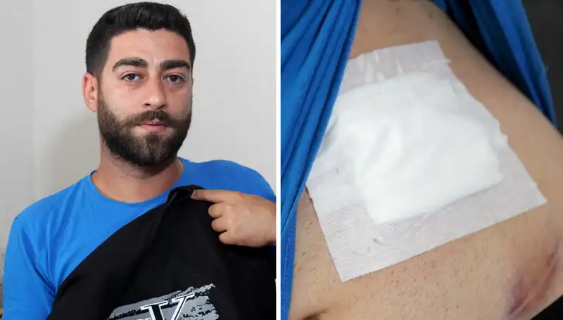 Karnında Ağrı Hissetti, Röntgen Sonucu Şok Edici Bir Gerçeği Ortaya Çıkardı