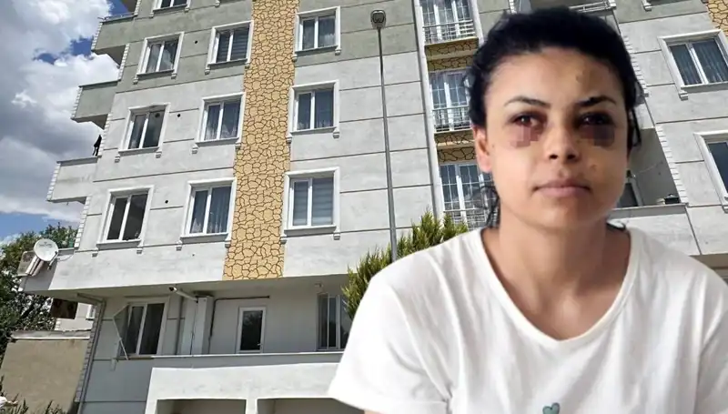 Düğünde Maganda Dehşeti: Saçmalar Gözüne İkna Olan Genç Kadın Hayat Mücadelesi Veriyor